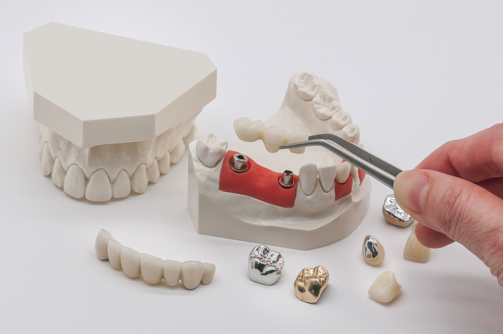 Biocompatible Dental Materials